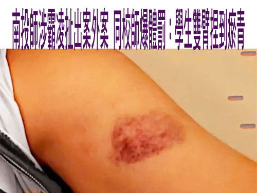 網路互嗆約真人PK！台中海線2國中生球場開打 校方急處置