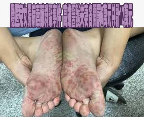 高雄校園爆腸病毒群聚 疾管署回應爭議案